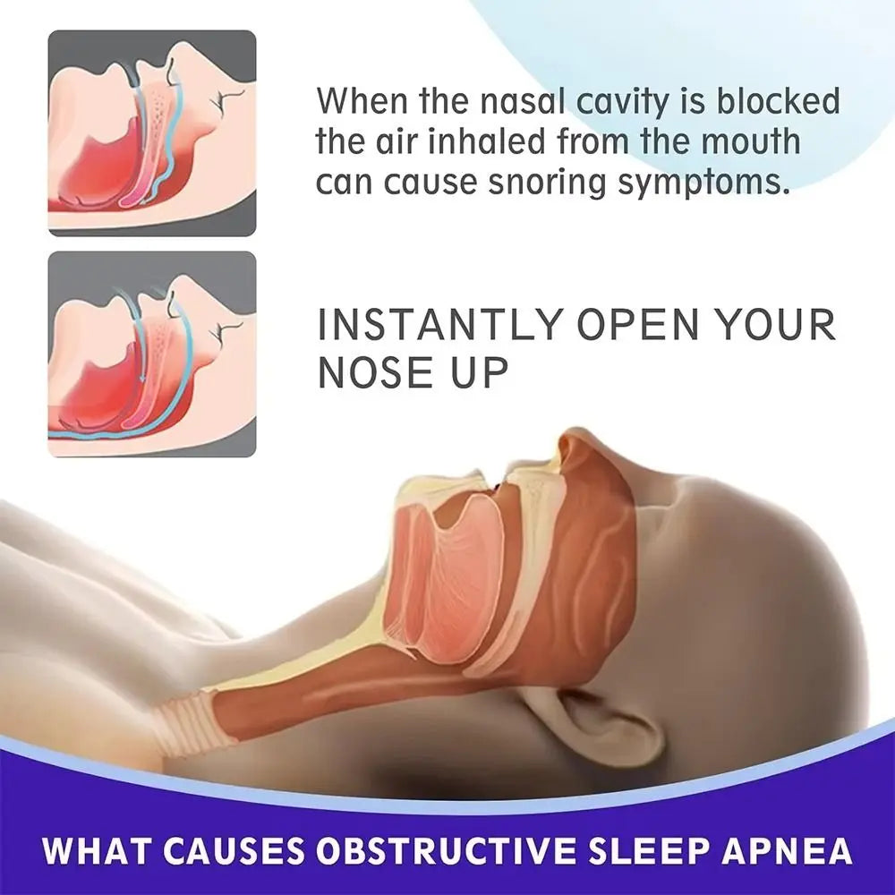 Noorliving Premium Nasal Strips (30 Pack) – Helps Reduce Snoring & Improve Breathing